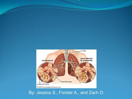 By: Jessica S., Forster A., and Zach D.. Definition A long term, progressive disease of the lungs that primarily causes shortness of breath. In people.