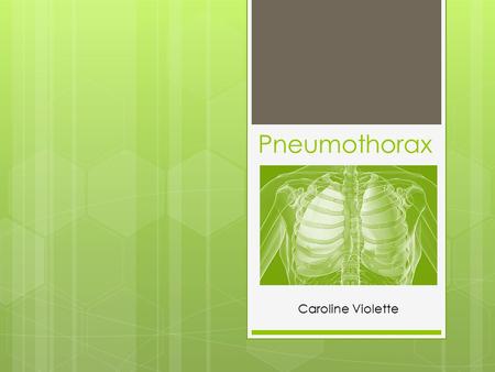 Pneumothorax Caroline Violette. What is Pneumothorax? A collapsed lung, or pneumothorax, is the collection of air in the space around the lungs; this.