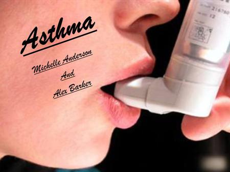 Asthma Michelle Anderson And Alex Barker. What is Asthma? Description Asthma is a complex, recurrent disease of the airways that causes shortness of breath,
