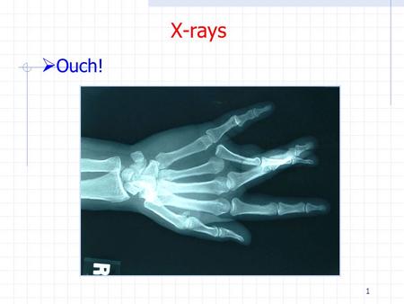 X-rays Ouch!.