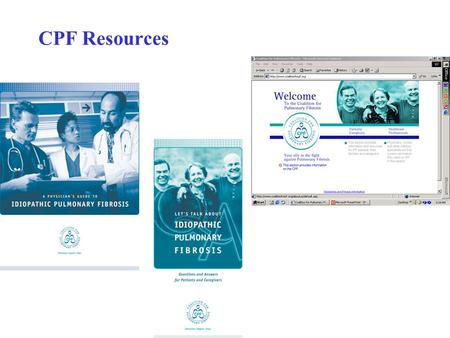 CPF Resources. Resources for IPF Patients Creation of “IPF Support Group Coordinator’s Kit” for local patient groups –Patient support groups: San Francisco,