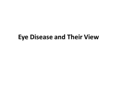 Eye Disease and Their View. – Color-Blind – Macular degeneration – Cataracts – Diabetic retinopathy – Glaucoma – Presbyopia-refractive error – Diplopia.