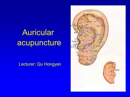 Auricular acupuncture