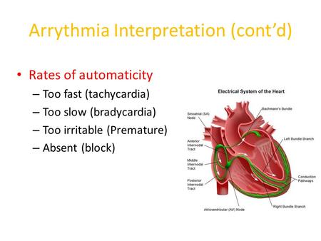 Arrythmia Interpretation (cont’d) Rates of automaticity – Too fast (tachycardia) – Too slow (bradycardia) – Too irritable (Premature) – Absent (block)
