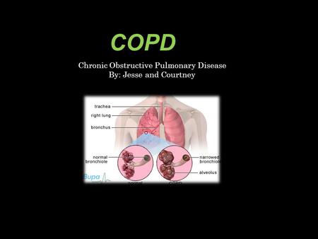 COPD Chronic Obstructive Pulmonary Disease By: Jesse and Courtney.