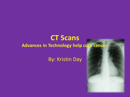 CT Scans Advances in Technology help cure cancer. By: Kristin Day.
