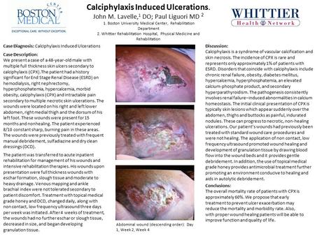Calciphylaxis Induced Ulcerations. John M. Lavelle, 1 DO; Paul Liguori MD 2 1. Boston University Medical Center, Rehabilitation Department 2. Whittier.
