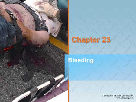Chapter 23 Bleeding.