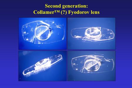 Second generation: Collamer™ (?) Fyodorov lens. Third generation: Staar ICL -Material: Hydrophilic collagen polymer (63% hydroxy- ethyl-methyl-acrylate;