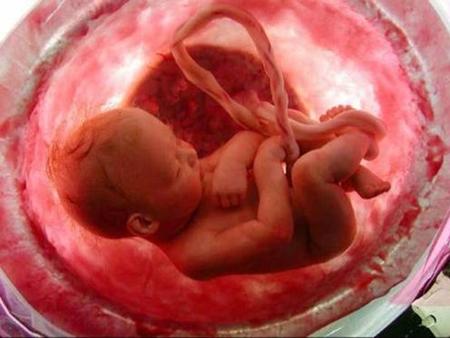 vocabulary Abortion (aborto) Caused (causado) Ethical (ético) Embryo (embrión) Decision (decisión) Anesthesia (anestesia) Miscarriage (aborto no provocado)