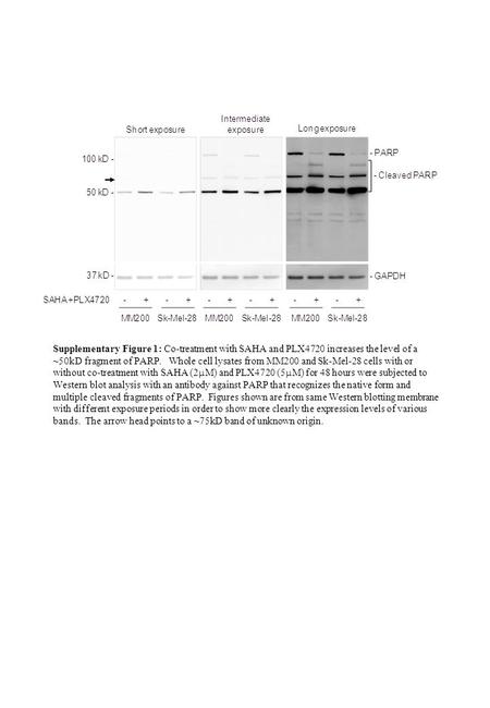Supplementary Figure 1: Co-treatment with SAHA and PLX4720 increases the level of a ~50kD fragment of PARP. Whole cell lysates from MM200 and Sk-Mel-28.