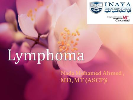 Lymphoma Nada Mohamed Ahmed , MD, MT (ASCP)i.