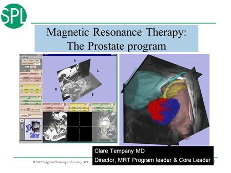 ©2005 Surgical Planning Laboratory, ARR Slide 1 Magnetic Resonance Therapy: The Prostate program Clare Tempany MD Director, MRT Program leader & Core Leader.
