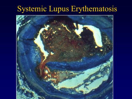 Systemic Lupus Erythematosis. The Immune System Immunology Connection to Tissue Engineering Develop methods to selectively block immune response to engineered.