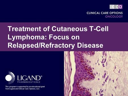 Treatment of Cutaneous T-Cell Lymphoma: Focus on Relapsed/Refractory Disease My name is John Zic, MD, and it is my pleasure to begin this presentation.