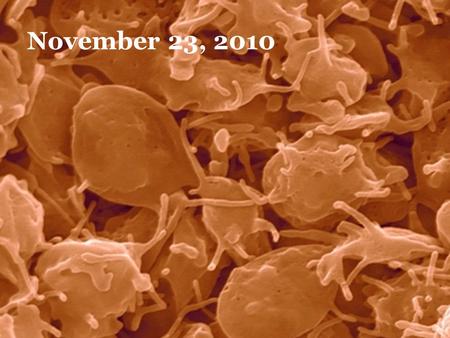 November 23, 2010. Idiopathic Throbocytopenic Purpura.