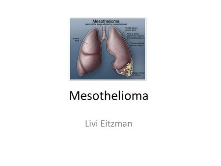 Mesothelioma Livi Eitzman. What is it? Mesothelioma is lung cancer. The cavities within the body encompassing the chest, abdomen, and heart are surround.