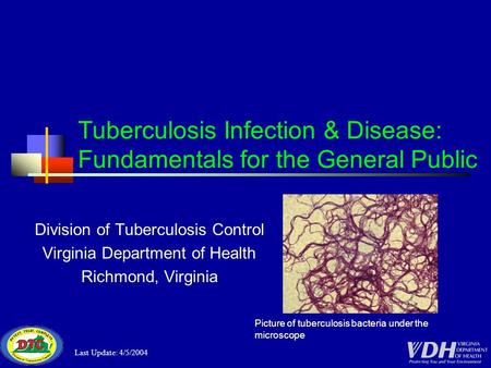 Tuberculosis Infection & Disease: Fundamentals for the General Public