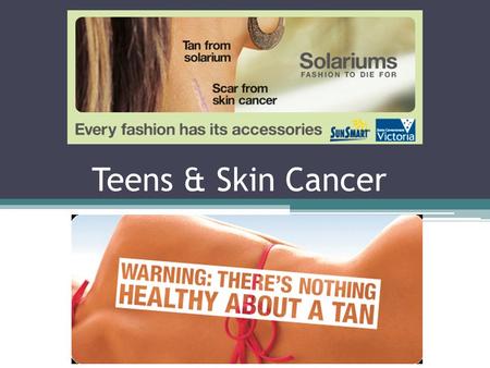Teens & Skin Cancer. How much do you know?  1. What are five ways you can protect yourself from skin cancer? (Hint- they all start with the letter S).