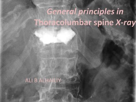 General principles in Thoracolumbar spine X-ray ALI B ALHAILIY.