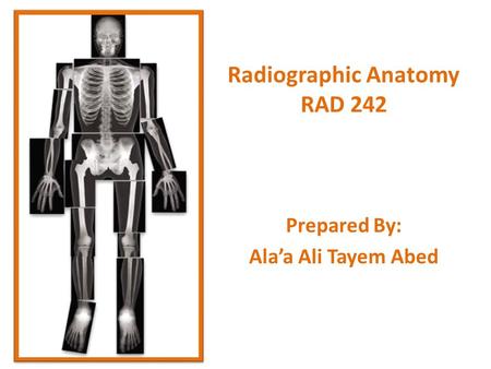 Radiographic Anatomy RAD 242 Prepared By: Ala’a Ali Tayem Abed.