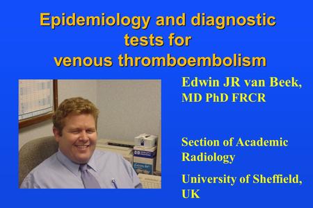 Epidemiology and diagnostic tests for venous thromboembolism Edwin JR van Beek, MD PhD FRCR Section of Academic Radiology University of Sheffield, UK.