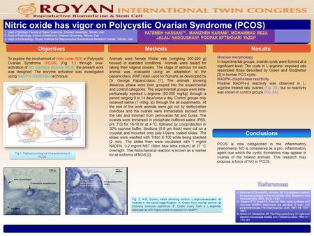 Conclusions Nitric oxide has vigor on Polycystic Ovarian Syndrome (PCOS) 1. Dept of Biology, Faculty of Basic Sciences, Shahed University, Tehran, Iran.