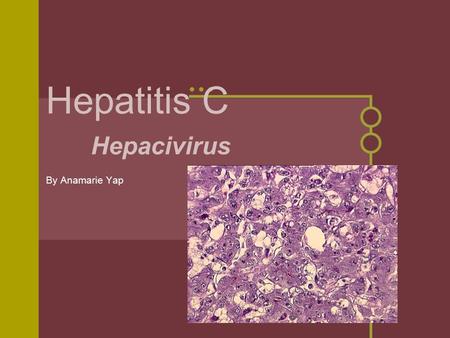 Hepatitis C Hepacivirus