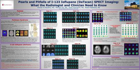 Pearls and Pitfalls of I-123 Ioflupane (DaTscan) SPECT Imaging: What the Radiologist and Clinician Need to Know Ammar A Chaudhry, MD, Maryam Gul, MD,