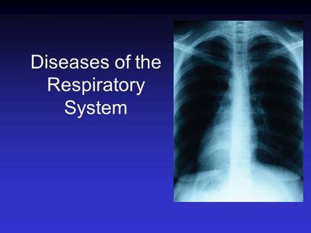 Diseases of the Respiratory System. Infections of the Respiratory tract Most common entry point for infections Upper respiratory tract –nose, nasal cavity,