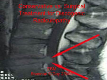 Conservative vs. Surgical Treatment for Discogenic Radiculopathy
