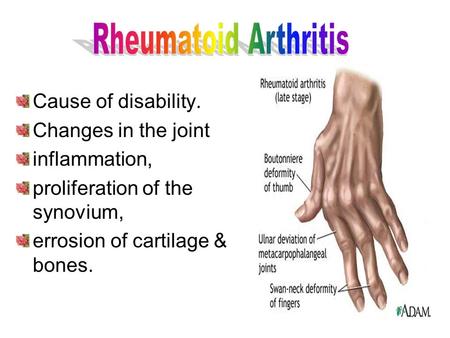 Cause of disability. Changes in the joint inflammation, proliferation of the synovium, errosion of cartilage & bones.