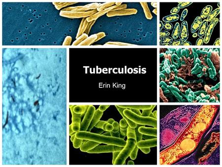 Tuberculosis Erin King. Introduction Tuberculosis is an infectious disease which primarily affects the lungs Its name is derived from the bacterial source.