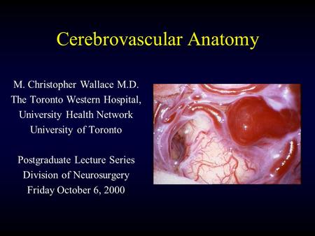 Cerebrovascular Anatomy