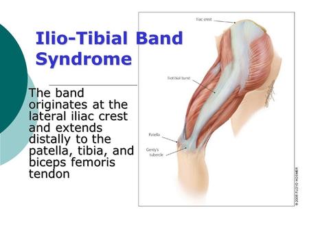 Ilio-Tibial Band Syndrome The band originates at the lateral iliac crest and extends distally to the patella, tibia, and biceps femoris tendon.