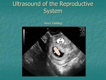 Ultrasound of the Reproductive System Stacy Fielding