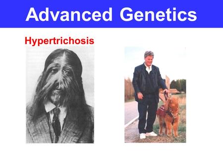 Advanced Genetics Hypertrichosis. Women have twice the number of X chromosomes as men do – how can this be? This means that they have twice the “gene.