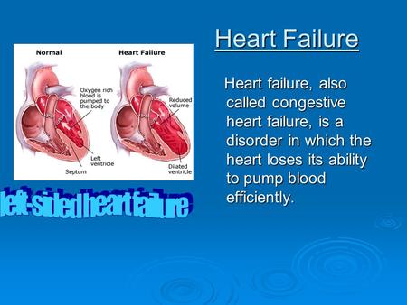 Heart Failure Heart Failure Heart failure, also called congestive heart failure, is a disorder in which the heart loses its ability to pump blood efficiently.