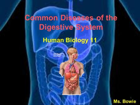 Ms. Bowie 1 Common Diseases of the Digestive System Human Biology 11.