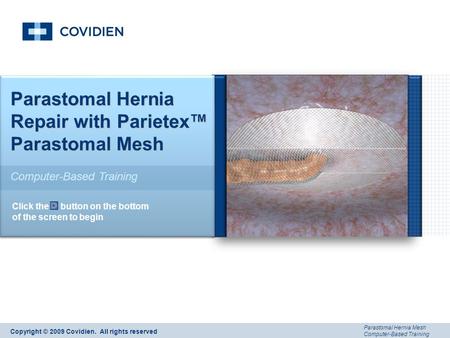 Parastomal Hernia Mesh Computer-Based Training