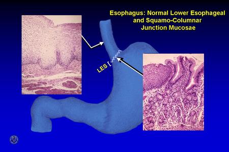 Esophagus: Normal Lower Esophageal and Squamo- columnar Junction Mucosae.