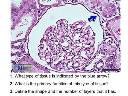 What type of tissue is indicated by the blue arrow?