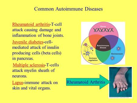 Common Autoimmune Diseases Rheumatoid arthritis-T-cell attack causing damage and inflammation of bone joints. Juvenile diabetes-cell- mediated attack of.