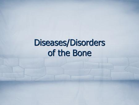 Diseases/Disorders of the Bone. Common Foot Disorders Hallux valgus Hallux valgus Hammertoe Hammertoe.