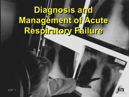 Diagnosis and Management of Acute Respiratory Failure ARF 1 ®