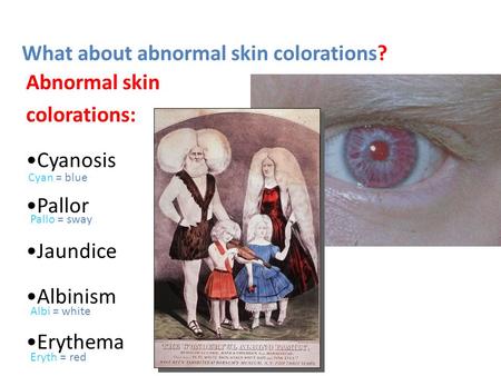 What about abnormal skin colorations? Abnormal skin colorations: