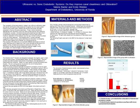 Ultrasonic vs. Sonic Endodontic Systems: Do they improve canal cleanliness and Obturation? Valerie Kanter and Emily Weldon Department of Endodontics, University.