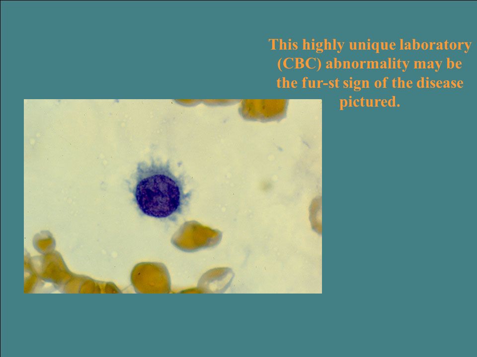 Powerpoint Lab Skeletons Cbc Template Body ambereasysite