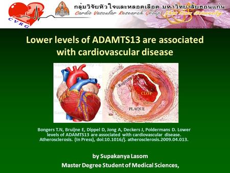 Lower levels of ADAMTS13 are associated with cardiovascular disease by Supakanya Lasom Master Degree Student of Medical Sciences, Bongers T.N, Bruijne.