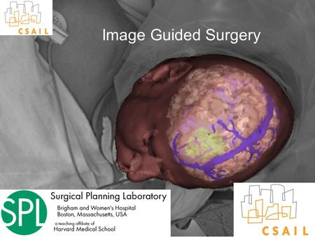 Slide 1 Image Guided Surgery. Slide 2 Conventional Surgery: Seeing surfaces Provided by Nakajima, Atsumi et al.
